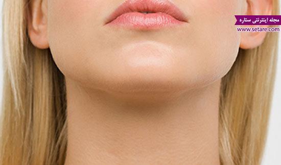 جراحی پروتز چانه چگونه انجام می گیرد؟ جراحی پروتز چانه چگونه انجام می گیرد؟